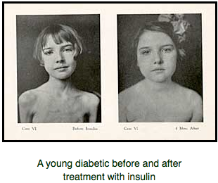 The Insulin Breakthrough - Frederick Banting- The Discovery of Insulin